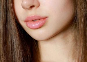 filler per le labbra